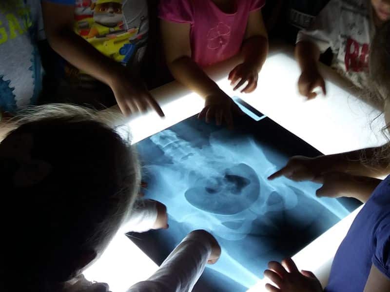 Un grupo de niños observa una radiografía en una mesa de luz en Infantil.